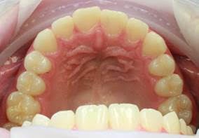 before clear correct 3