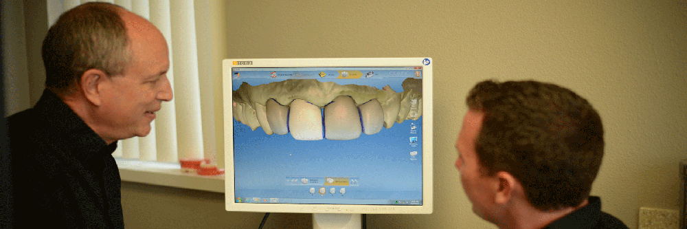 cerec image
